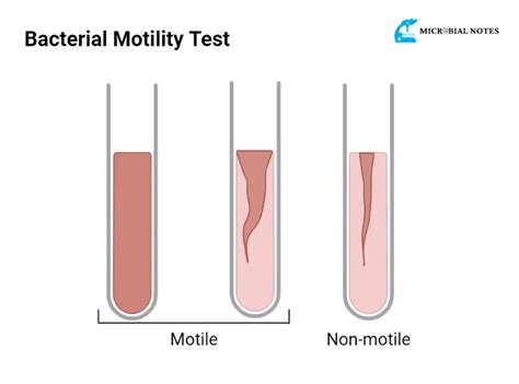 soft agar motility test|motility positive vs negative.